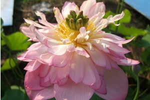 平安e生保百万医疗怎么样？优缺点是什么？-保点通